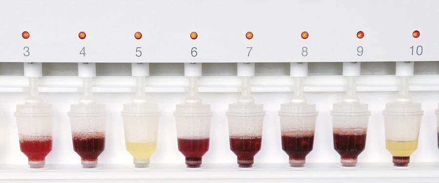 In jedem der acht Gefäße wird ein Peptid synthetisiert In jedem der acht Gefäße wird ein Peptid synthetisiert