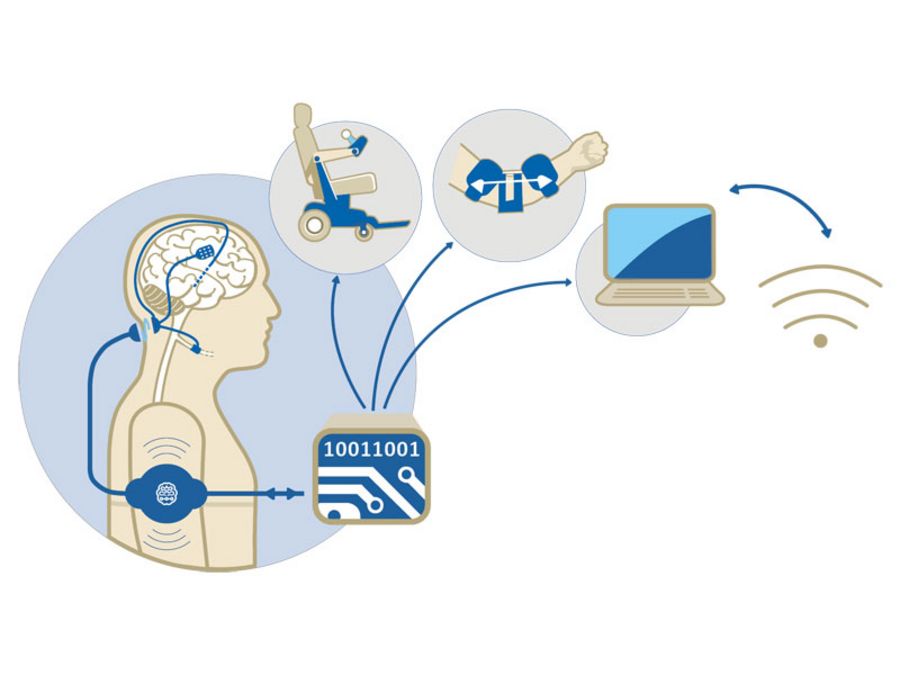 CorTec Funktionsmodell des Brain Interchange-Systems CorTec Funktionsmodell des Brain Interchange-Systems