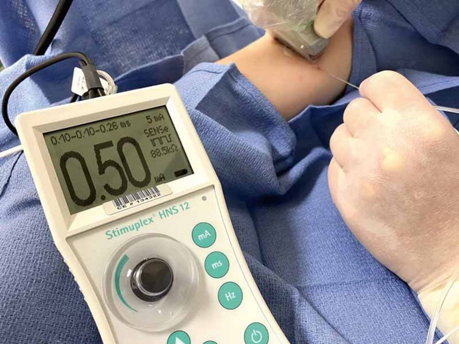 Stockert Nervenstimulator Stimuplex® HNS12