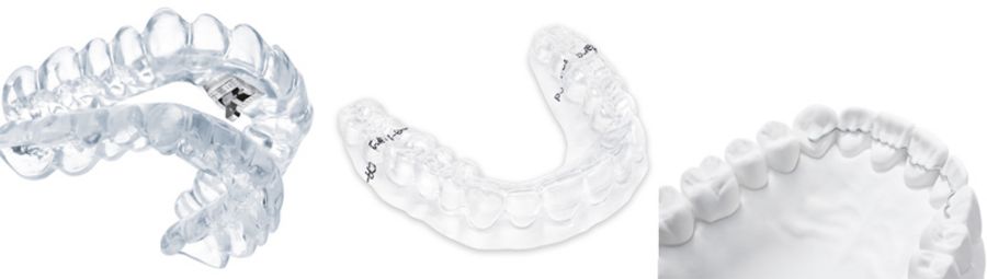 Scheu Dental Zahnschienen Scheu Dental Zahnschienen