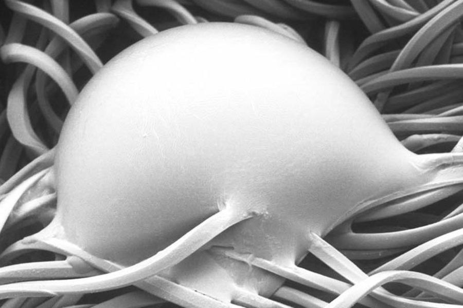 Modernste Materialien: Mikrostruktur eines Einlagegewebes Modernste Materialien: Mikrostruktur eines Einlagegewebes