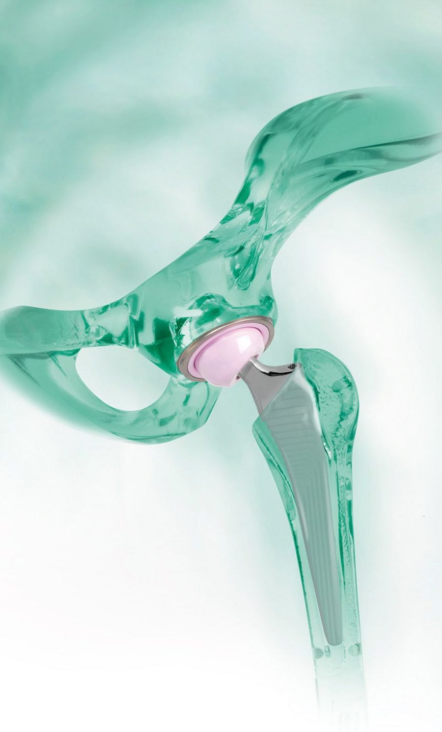 Implantcast Hüftendoprothetik 