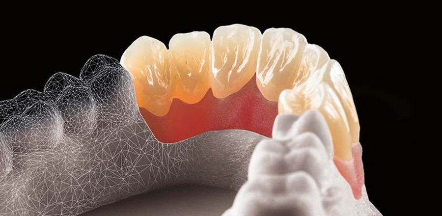 Dental Direkt Frontzahnrestauration Dental Direkt Frontzahnrestauration